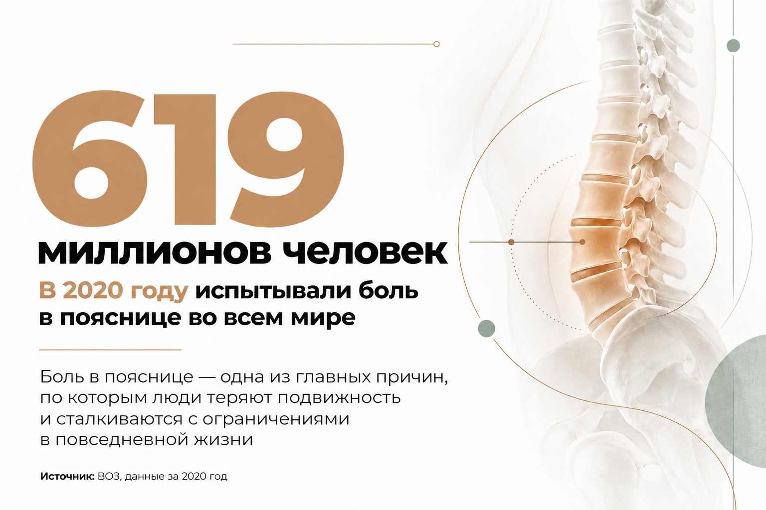 Боль в спине: когда нужна диагностика и как восстановить подвижность — фото 2